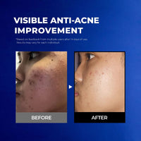 NavyX OilZero Acne Men's Cleanser 男士控油洗面奶