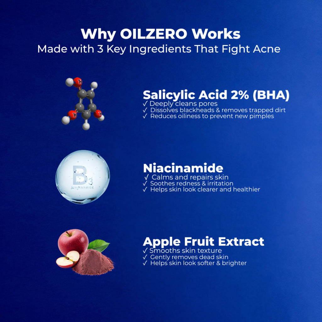 NavyX OilZero Acne Men's Cleanser 男士控油洗面奶