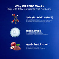 NavyX OilZero Acne Men's Cleanser 男士控油洗面奶