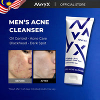 NavyX OilZero Acne Men's Cleanser 男士控油洗面奶