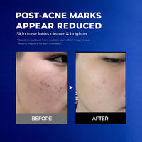 NavyX OilZero Acne Men's Cleanser 男士控油洗面奶
